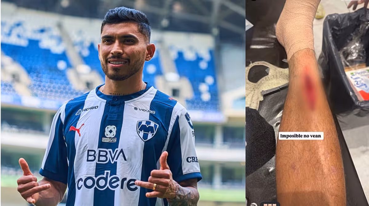 Blessure impressionnante pour Pineda après un tacle agressif