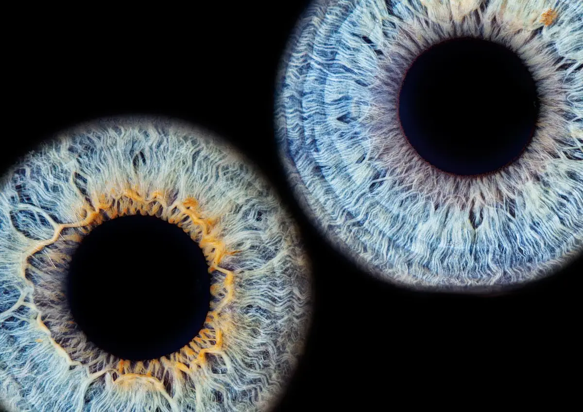 Thérapies oculaires frauduleuses : quels sont les risques ?